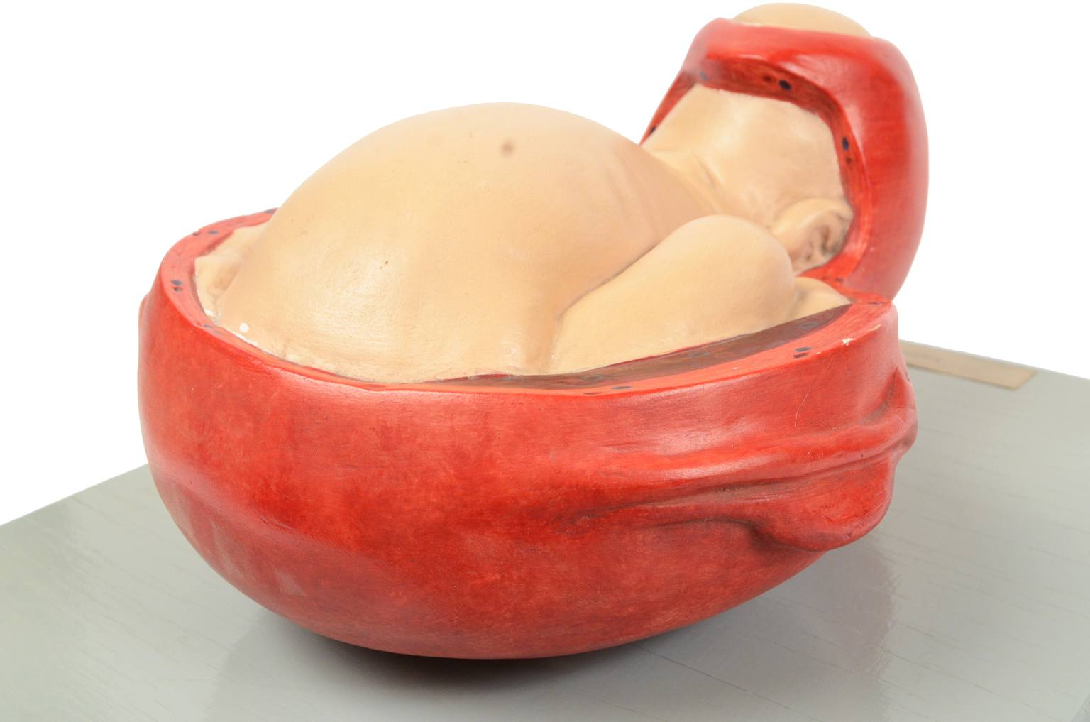 Strumenti medici d'epoca/4075-Bambino che nasce