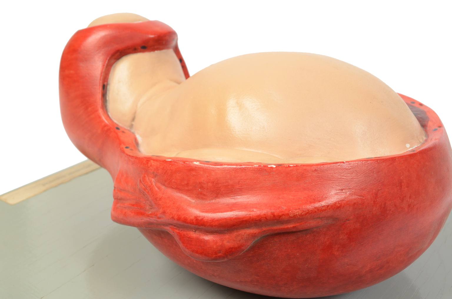 Strumenti medici d'epoca/4075-Bambino che nasce