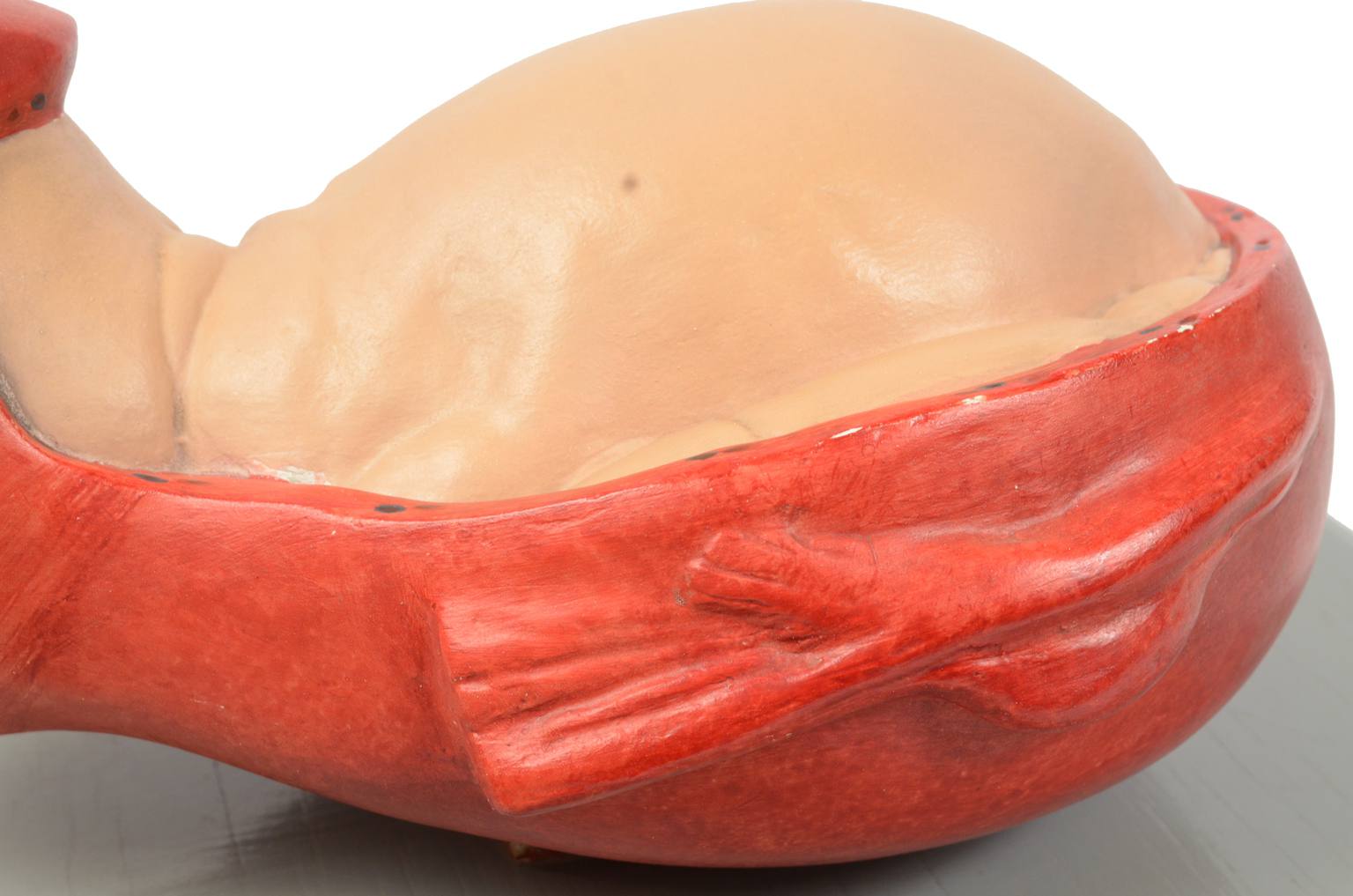 Strumenti medici d'epoca/4075-Bambino che nasce