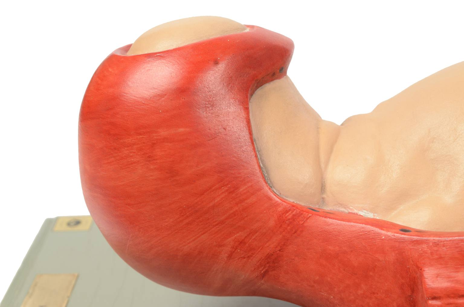 Strumenti medici d'epoca/4075-Bambino che nasce