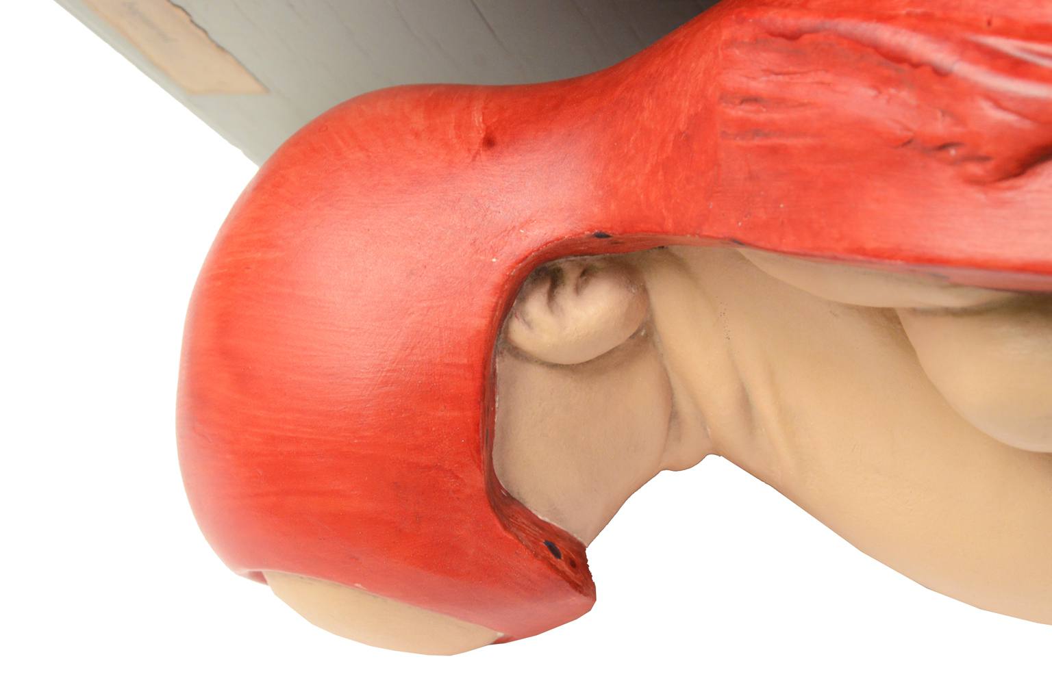 Strumenti medici d'epoca/4075-Bambino che nasce