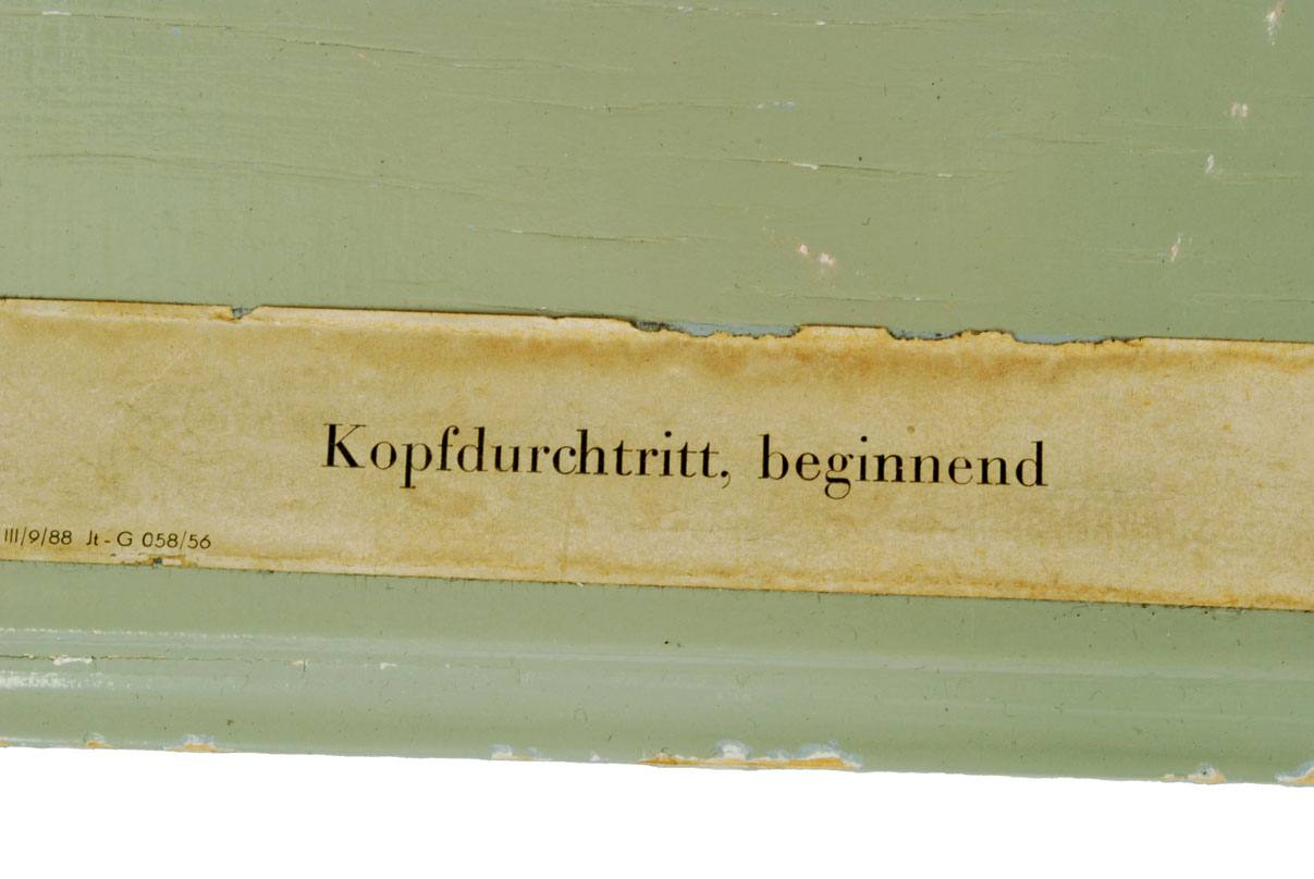 Old medical instruments/4075-Borning baby