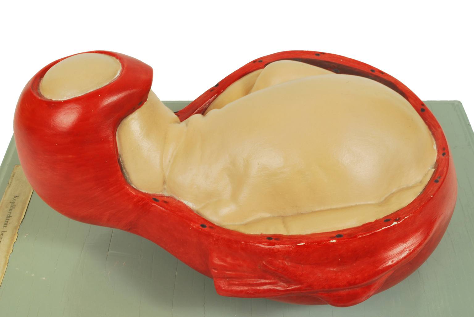 Old medical instruments/4075-Borning baby