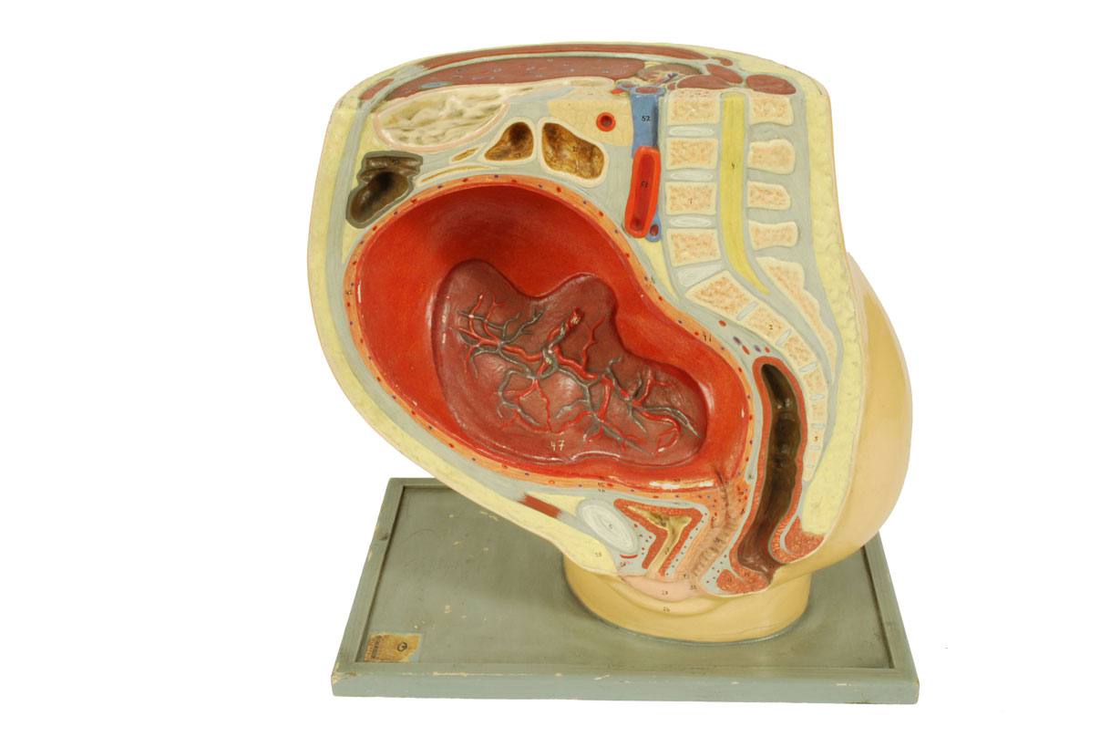 Old medical instruments/4076-Woman womb