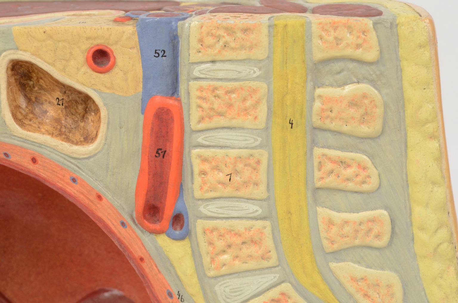 Old medical instruments/4076-Woman womb