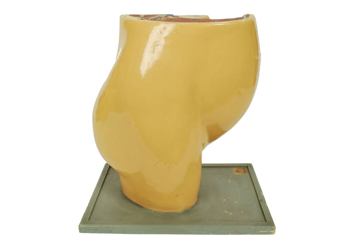 Old medical instruments/4076-Woman womb