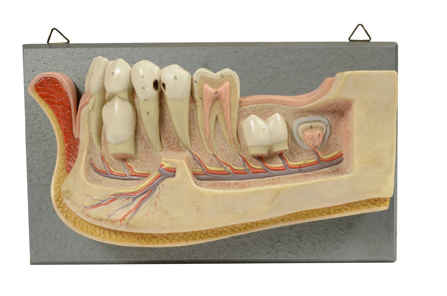 Old medical instruments/541A-Jaw model