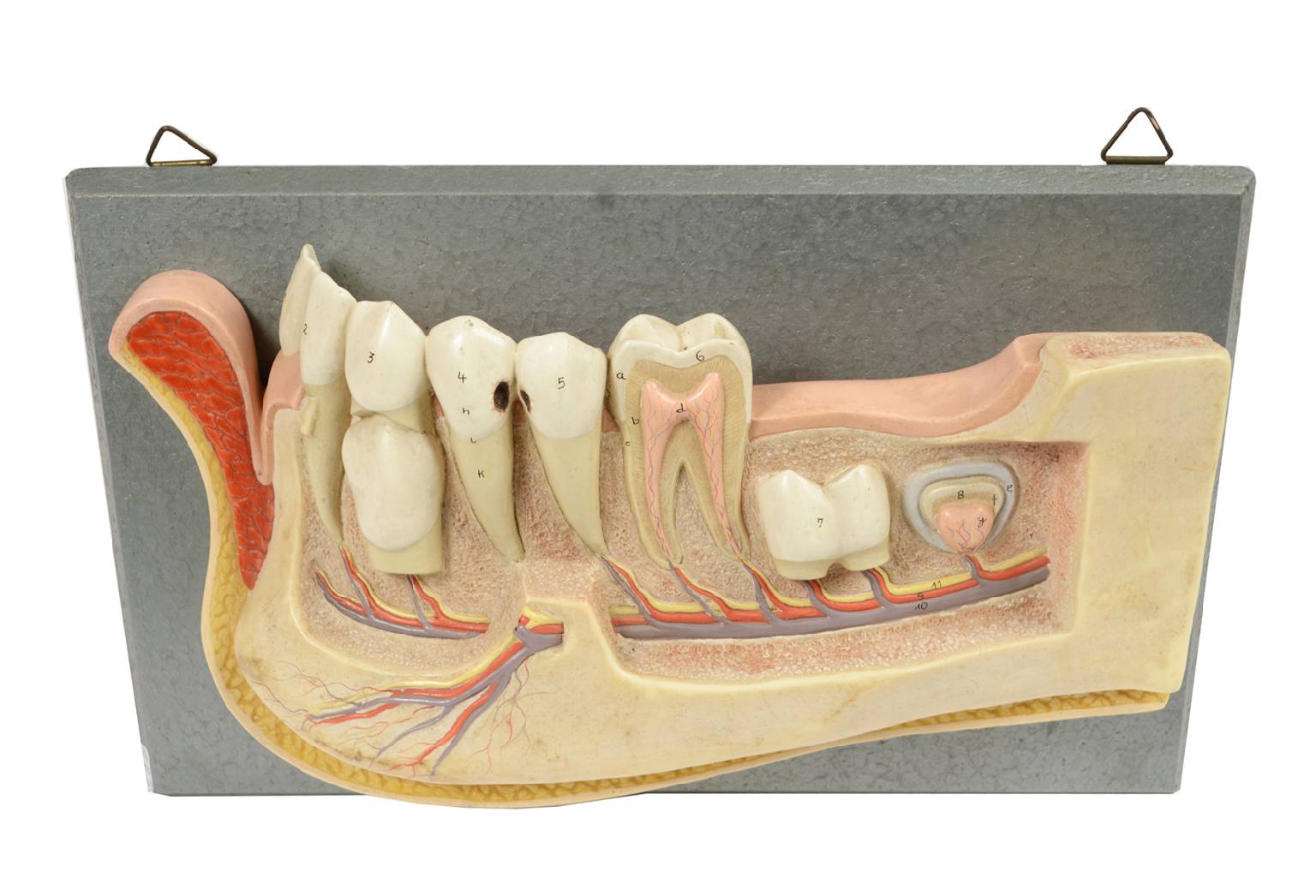 Old medical instruments/541A-Jaw model