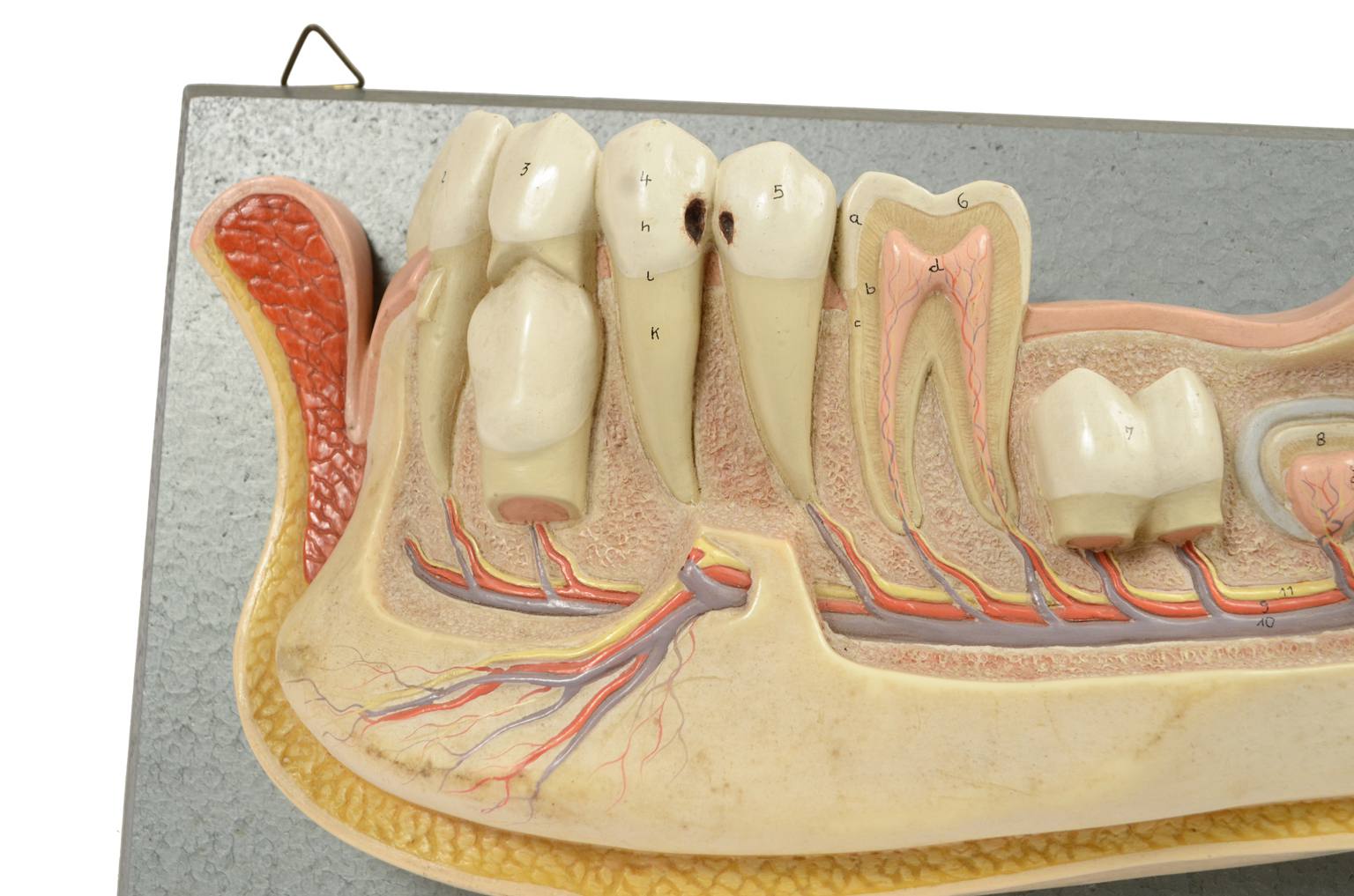 Strumenti medici d'epoca/541A-Modello mandibola
