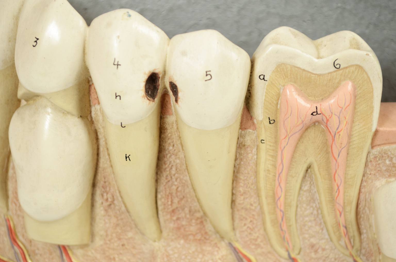 Strumenti medici d'epoca/541A-Modello mandibola