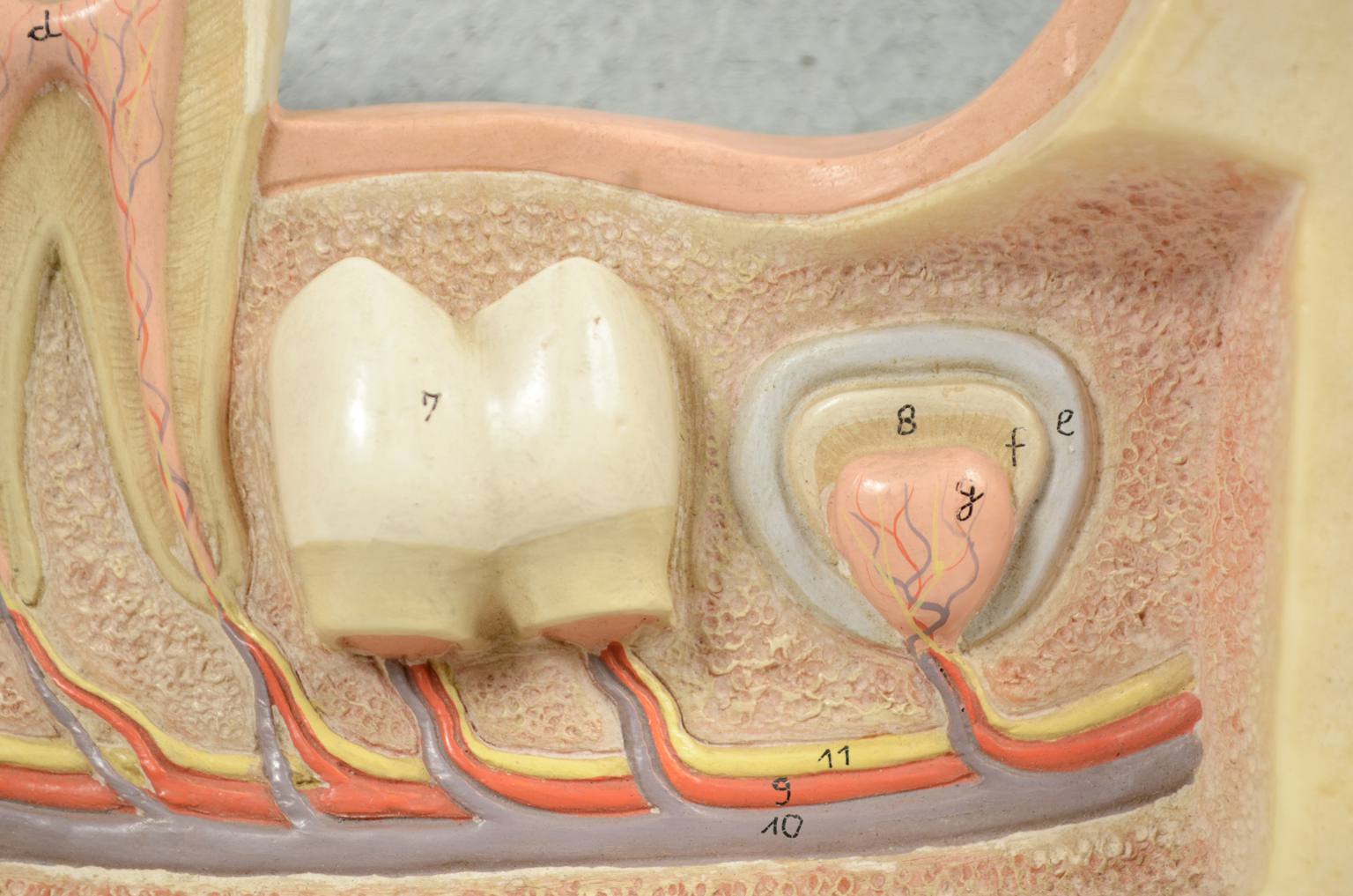 Strumenti medici d'epoca/541A-Modello mandibola