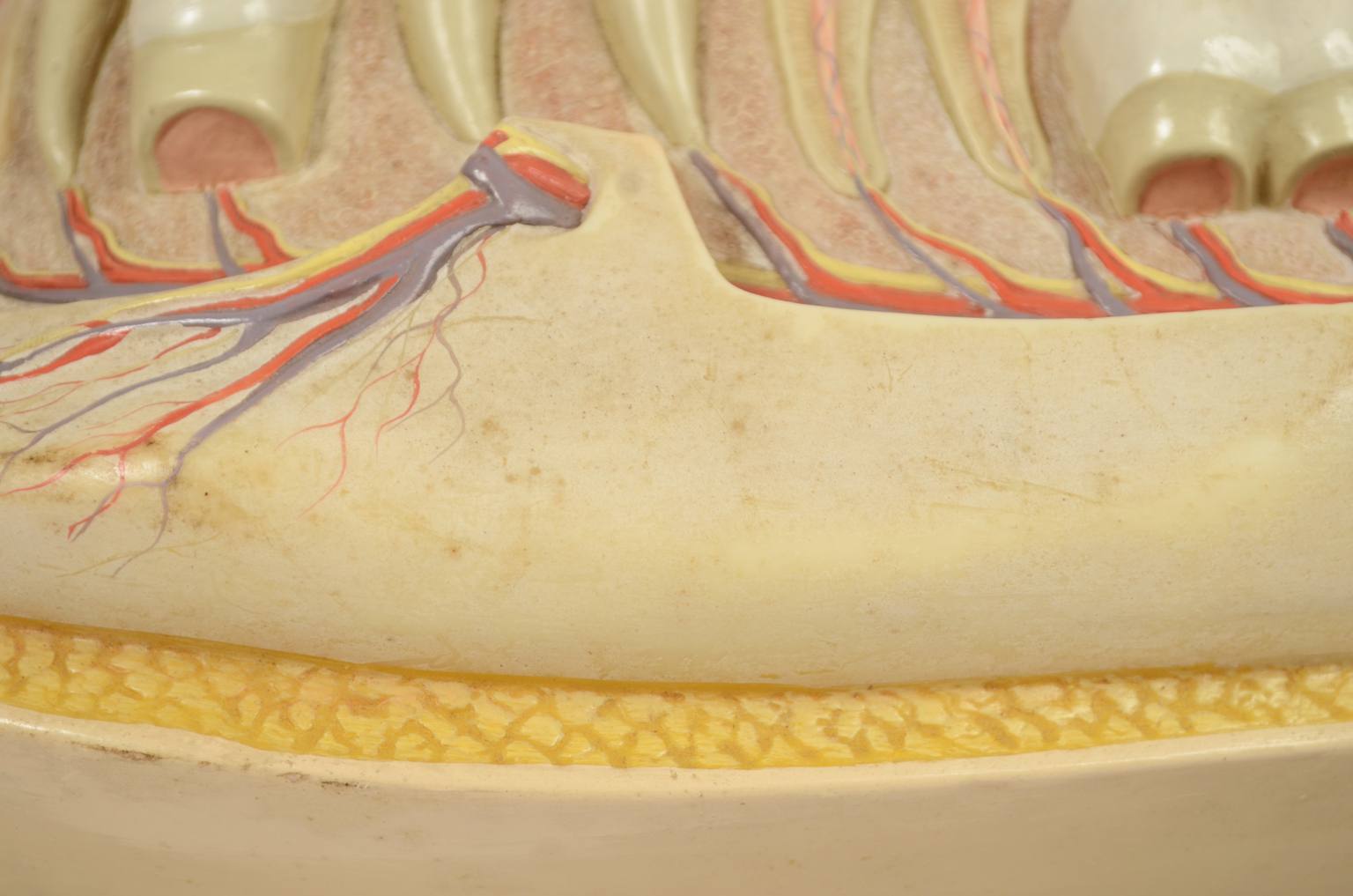 Strumenti medici d'epoca/541A-Modello mandibola