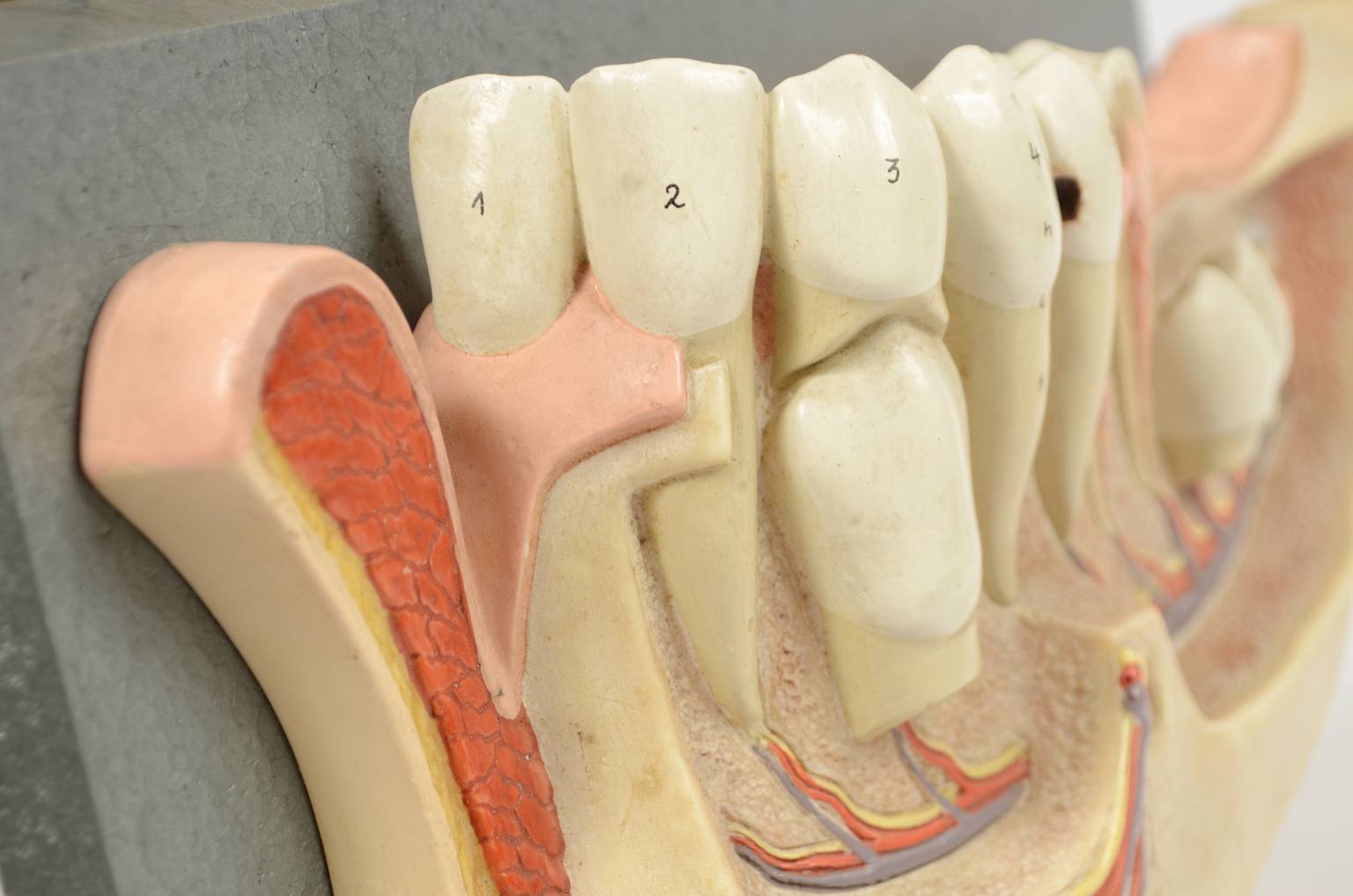 Strumenti medici d'epoca/541A-Modello mandibola