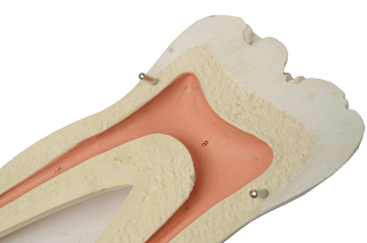 Old medical instruments/5803-Model of molar tooth