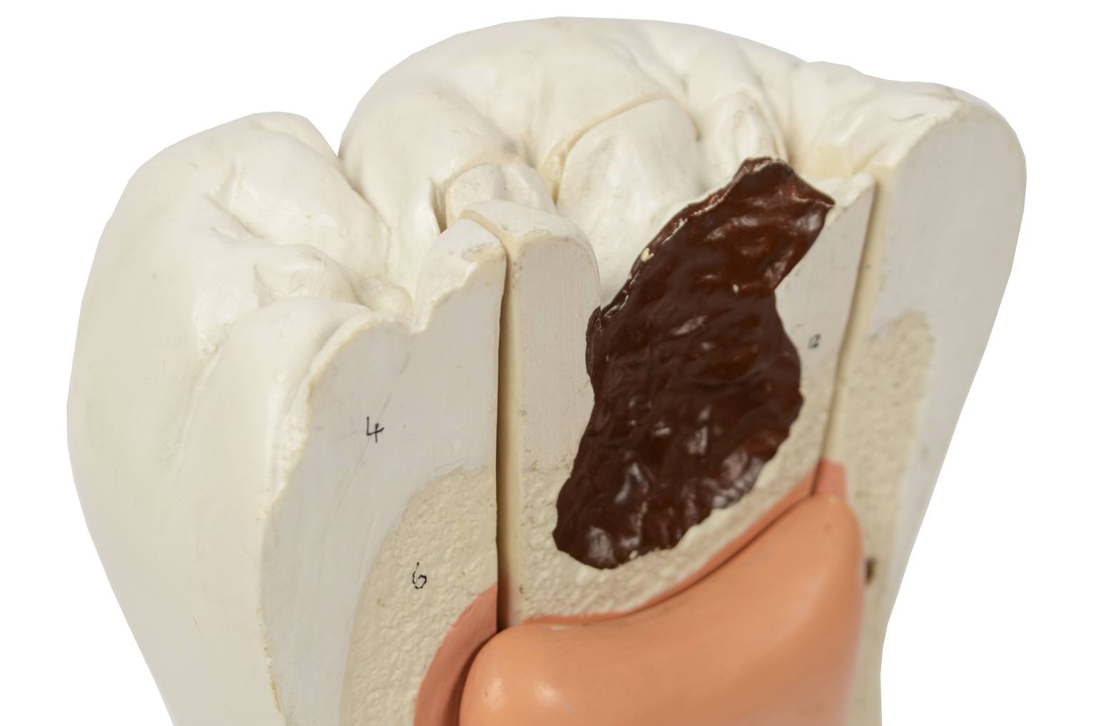 Old medical instruments/5803-Model of molar tooth