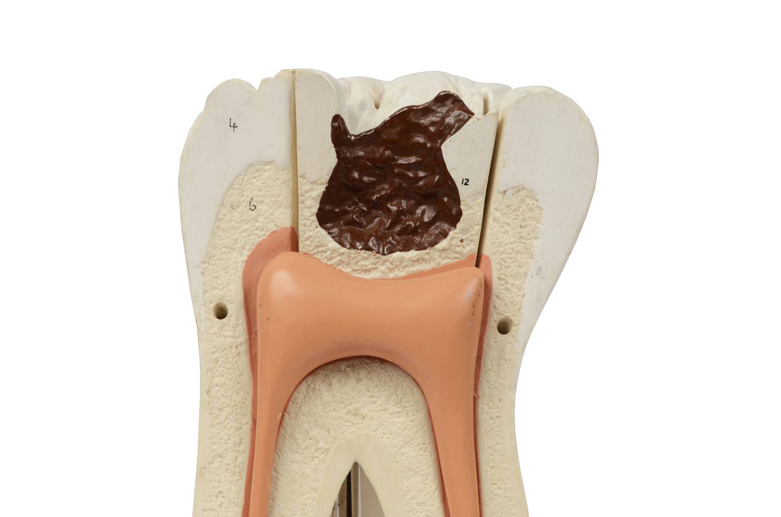 Old medical instruments/5803-Model of molar tooth