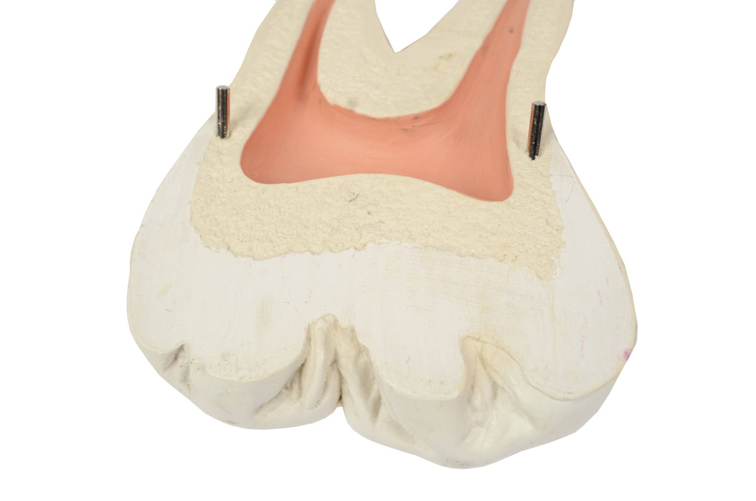 Old medical instruments/5803-Model of molar tooth