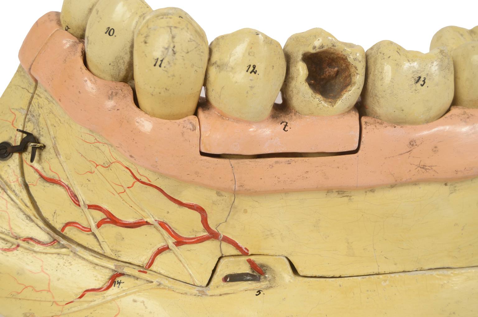 Old medical instruments/614-Mandible model
