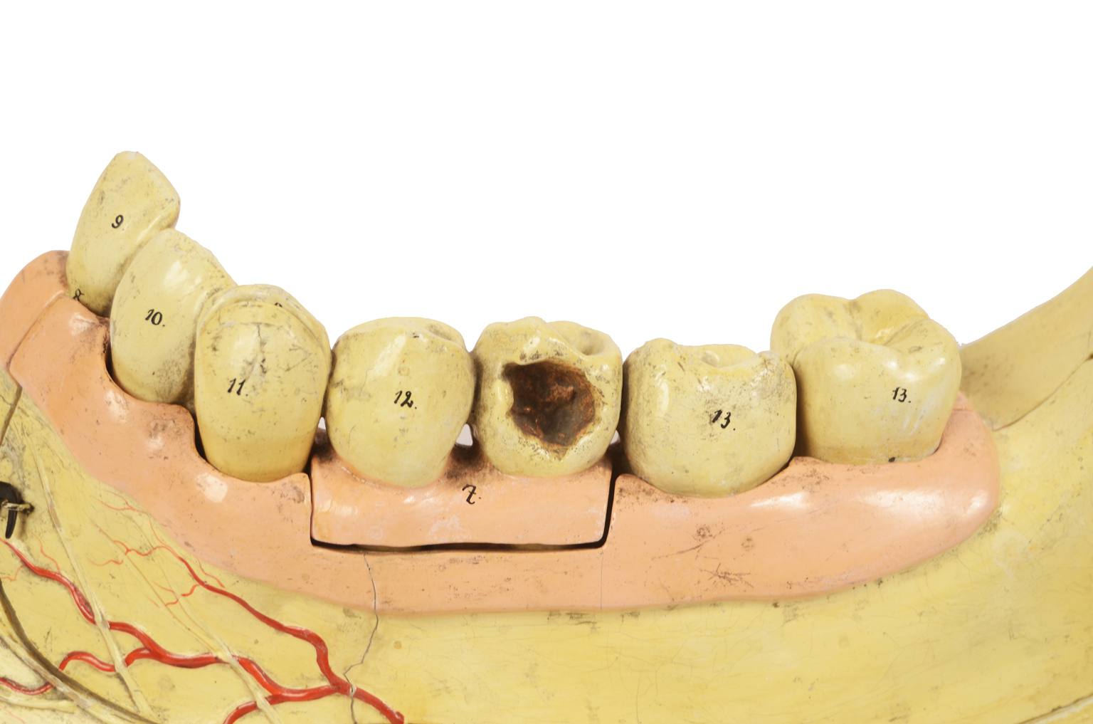 Old medical instruments/614-Mandible model
