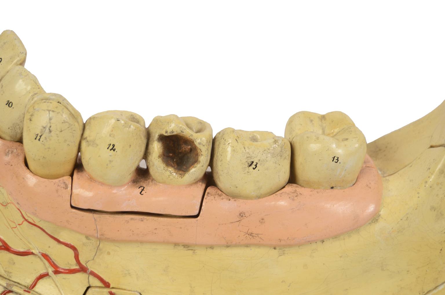 Old medical instruments/614-Mandible model
