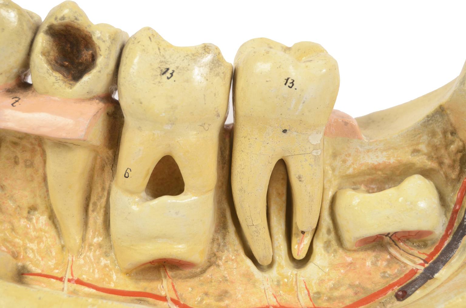 Old medical instruments/614-Mandible model