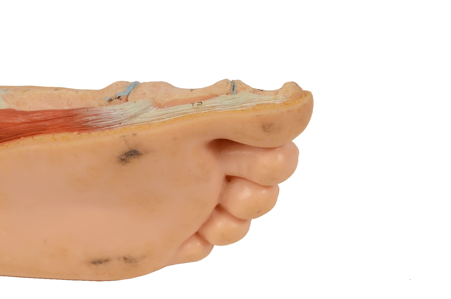 Strumenti medici d'epoca/7307-Piede Normale Modello