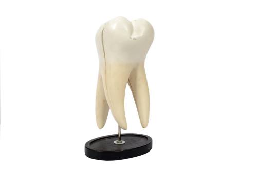 Code 5803 Model of molar tooth