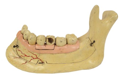 Code 614 Mandible model